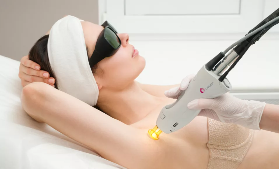 epilation laser rouen