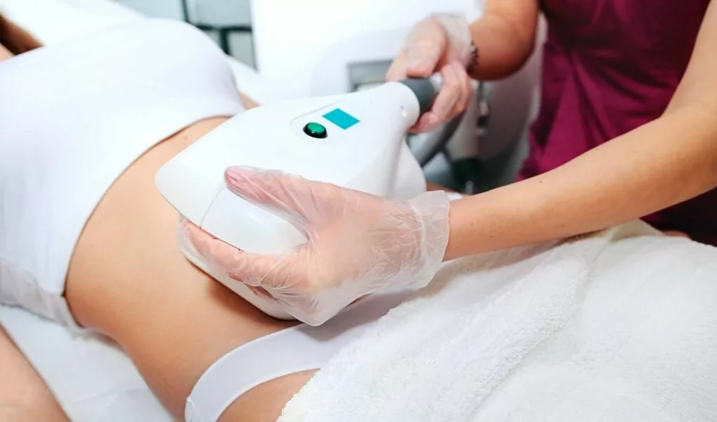 la cryolipolyse pour aider à perdre du poids